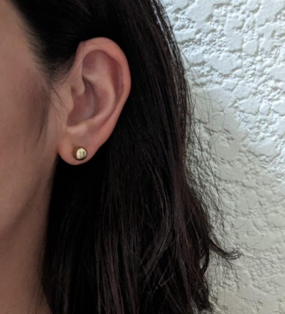 lobulo-auricular
